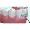 Hilo dental inalámbrico4